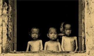 ▲ 영양부족 상태의 북한 어린이들.(자료사진)