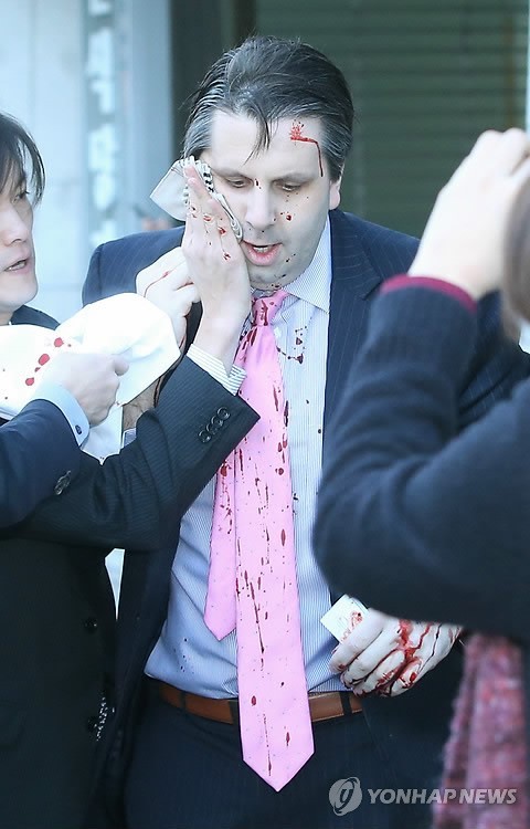 ▲ 마크 리퍼트 주한 미대사가 5일 오전 서울 세종문화회관에서 열린 민화협 주최 초청 강연에 참석했다가 괴한의 공격을 받고 피를 흘리며 병원으로 향하고 있다.  ⓒ 연합뉴스