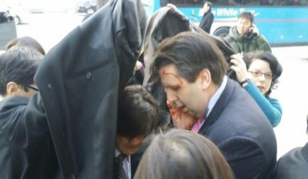 ▲ 김기종의 테러 직후 강북삼성병원으로 가는 마크 리퍼트 주한 美대사. ⓒSNS 유포 사진 캡쳐