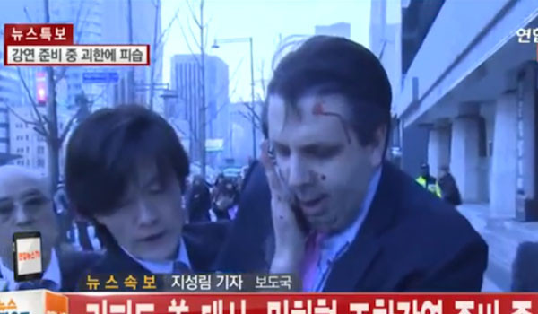 ▲ 김기종의 테러 직후 피를 흘리며 차량으로 이동하는 마크 리퍼트 주한 美대사. 김기종의 테러로 길이 11cm, 깊이 3cm의 상처를 입었다고 한다. ⓒ채널Y 보도화면 캡쳐