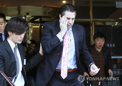 ▲ 마크 리퍼트 주한 미대사가 5일 오전 세종문화회관에서 열린 초청 강연에 참석했다가 '우리마당' 대표 김기종에게 공격을 받고 피를 흘리며 행사장을 빠져나가고 있다.ⓒ 연합뉴스