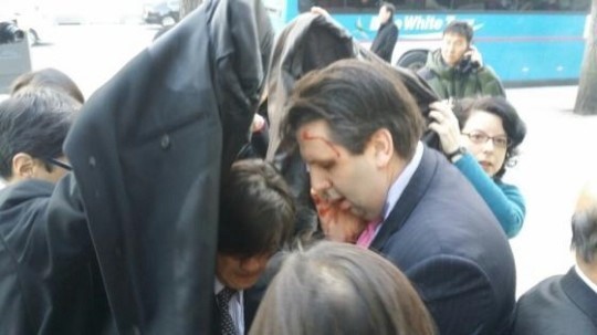 ▲ 지난 5일 반미종북 성향의 김기종에게 테러당한 직후 마크 리퍼트 美대사가 경찰차로 발걸음을 옮기는 모습. ⓒSNS 유포사진 캡쳐