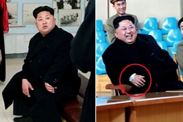 ▲ 지난 9일 北선전매체들은 오른손 손목에 붕대를 감은 김정은의 모습을 보도했다. ⓒSBS 관련 보도화면 캡쳐