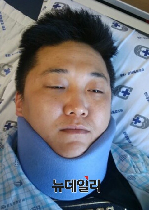 ▲ 노동절인 1일 밤 세월호 시위대 30여명에게 폭행당해 전치 3주의 부상을 입은 인터넷방송 BJ 한모씨. ⓒ뉴데일리 정재훈 기자