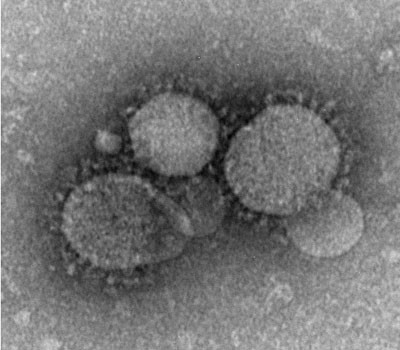 ▲ 중동호흡기증후군의 원인인 '코로나 바이러스(MERS-CoV)' 현미경 사진. ⓒ위키피디아 공개사진