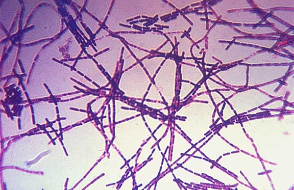 ▲ 그람 염색을 한 탄저균 포자의 모습. ⓒ위키피디아 공개사진