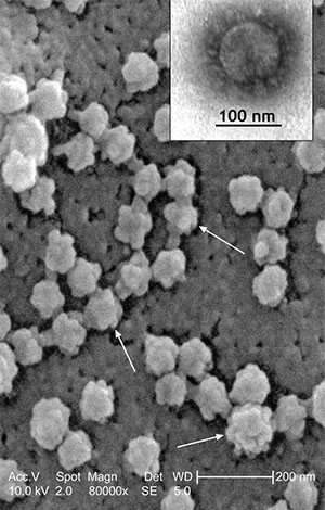 ▲ 중국 광둥성에서 처음 시작돼 전 세계로 확산됐던 SARS 코로나 바이러스(CoV). Ⓒ 위키피디아 공개사진