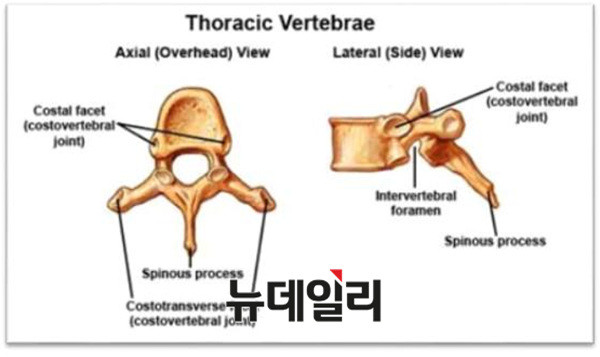 ▲ ▲흉추 부분 극상돌기의 모습. ⓒ 뉴데일리
