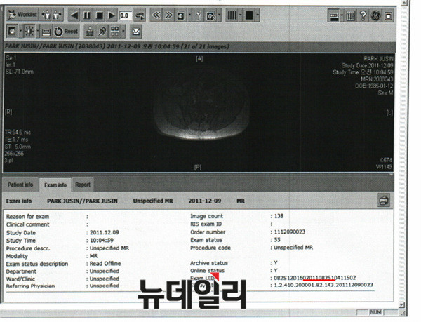 ▲ ▲자생병원의 MRI와 엑스레이는 세브란스 팩스 서버에 입력돼 있다. 사진은 두 영상의 Exam Info 화면. ⓒ 뉴데일리