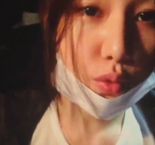 ▲ 김예원ⓒ인스타그램