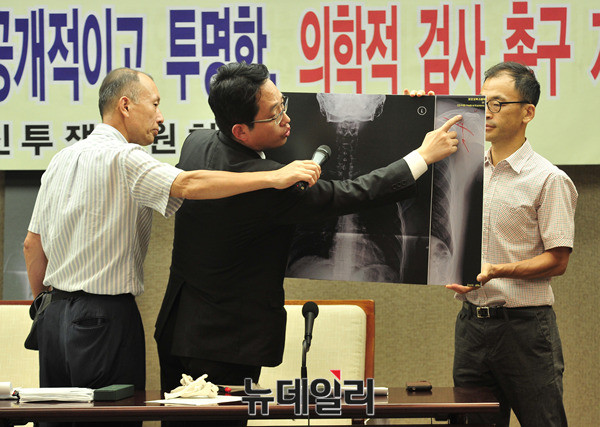 ▲ 의사단체인 의료혁신투쟁위원 회최대 공동대표가, 10일 서울 중구 프레스센터에서 열린 기자회견에서 박주신씨 명의의 공군 엑스레이와 비자발급용 엑스레이, 자생병원 엑스레이를 비교 판독한 결과 나타나는 의학적 차이점을 설명하고 있다. ⓒ 뉴데일리DB