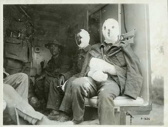 ▲ 1차 세계대전 당시 독일군의 '겨자 가스' 공격에 당한 연합군 모습. ⓒ캐나다 전쟁기념관 홈페이지 캡쳐