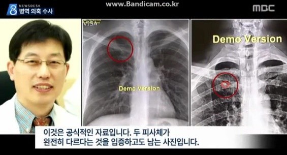 ▲ 박주신씨 병역비리 의혹을 제기하고 있는 영상의학 전문의 양승오 박사(사진 왼쪽). ⓒ MBC 뉴스데스크 화면 캡처