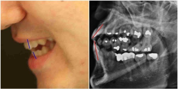 ▲ 실제 박주신씨 인물사진에 나타난 치아모습(왼쪽)과 자생병원 구외 엑스레이에 나타난 치아사진(오른쪽). ⓒ 뉴데일리DB