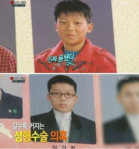 ▲ 허경환ⓒKBS2 '인간의 조건' 방송캡처