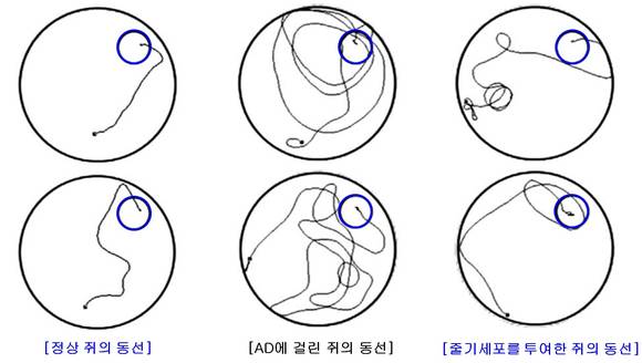 ▲ 그림 1: '수중미로검사'를 이용하여 기억력 손상 정도를 확인하기 위해, 파란색으로 표시된 도피대를 찾기까지의 동선을 비교한 사진으로, 줄기세포를 투여한 동물군의 동선이 정상 쥐의 동선에 가깝게 향상되었음을 확인할 수 있다.ⓒ차병원그룹