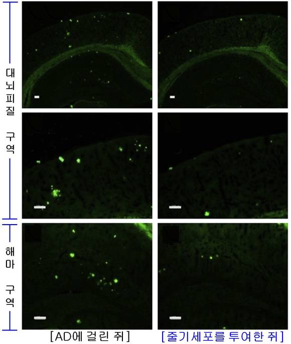 그림 2: 알츠하이머 증상을 유발하는 '아밀로이드-베타(밝은 색으로 표시된 점)'의 축적 정도를 비교한 결과, 줄기세포를 투여한 쥐의 뇌에는 아밀로이드-베타의 축적이 현저히 감소되었음을 확인할 수 있다.ⓒ차병원그룹