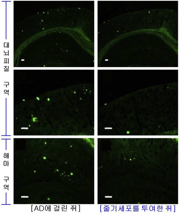 ▲ 그림 2: 알츠하이머 증상을 유발하는 '아밀로이드-베타(밝은 색으로 표시된 점)'의 축적 정도를 비교한 결과, 줄기세포를 투여한 쥐의 뇌에는 아밀로이드-베타의 축적이 현저히 감소되었음을 확인할 수 있다.ⓒ차병원그룹