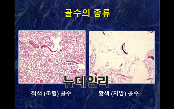 ▲ 조혈골수와 지방골수의 모습. ⓒ 차기환 변호사 제공