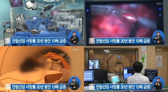 ▲ ⓒKBS 방송화면 캡쳐