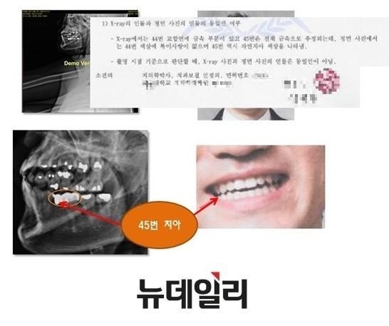 ▲ 서울 유명대학교 치대 교수가 박주신씨 명의의 치아 엑스레이와 실제 인물사진을 비교한 결과, 동일인이 아니라고 판독한 소견서. ⓒ 뉴데일리DB
