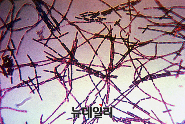 ▲ 탄저균 모습.ⓒ미국 CDC