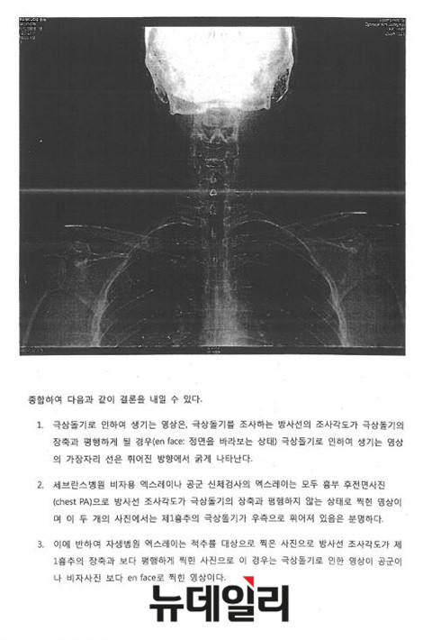 ▲ 재판부가 4일 공개한 박주신씨 명의 엑스레이 3장에 관한 감정서 중 일부. ⓒ 차기환 변호사