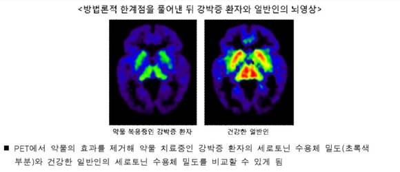 ▲ 정신건강의학과 김의태 교수ⓒ분당서울대학교병원