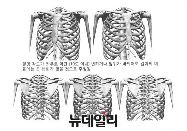 ▲ 감정서 첨부자료 중 일부. 엑스레이 촬영 시 촬영각도가 골격의 길이비율에 큰 영향을 미치지 못한다는 것을 나타내고 있다.  ⓒ차기환 변호사