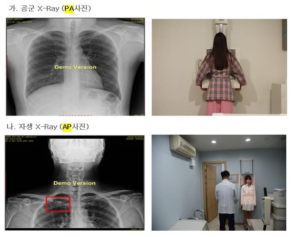 ▲ 엑스레이 촬영 방식인 AP와 PA의 자세, 방사선 조사방향 차이. ⓒ차기환 변호사