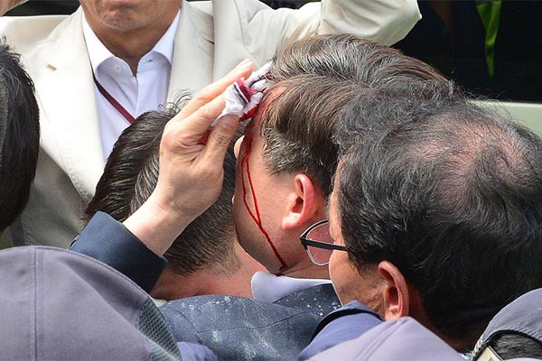 ▲ 지난 15일 시위대가 던진 물건에 맞아 눈썹 위쪽이 찢어진 조희현 경북경찰청장. 이를 단순 농민시위로 보기는 어렵다. ⓒ조선닷컴 보도화면 캡쳐