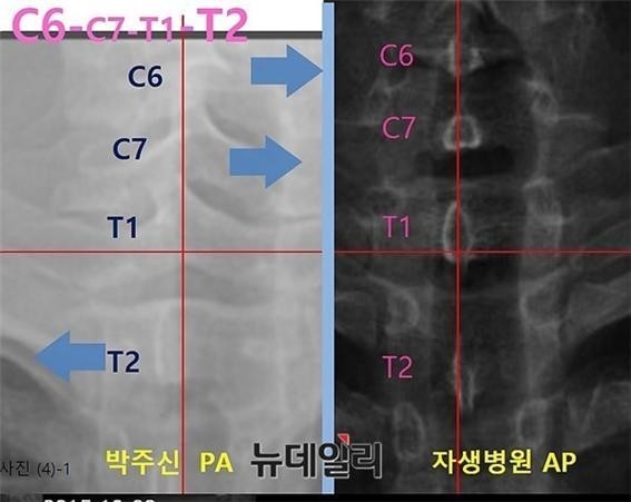 ▲ 박원순 서울시장이 지난해 10월 서울시청에서 열린 국회 국정감사에서, 아들 주신씨의 병역비리 의혹과 관련된 질의를 받고 불편한 표정을 짓고 있다. ⓒ 뉴데일리DB