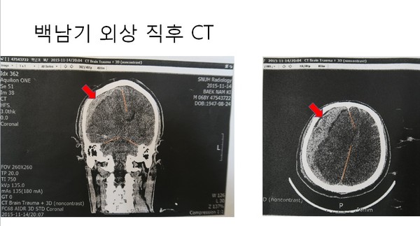 ▲ 사고 당시 상황을 재연해 보이고 있는 이용식 교수.