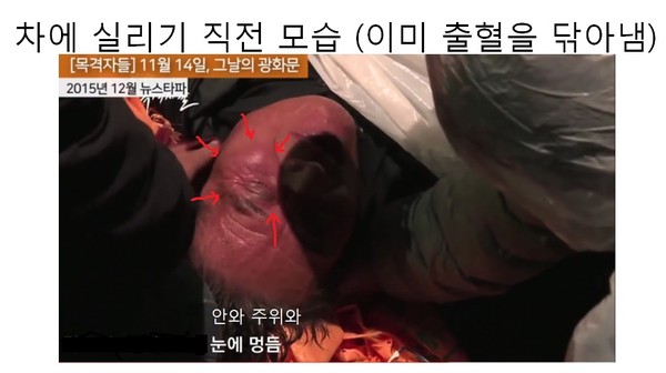 ▲ 사고 당시 상황을 재연해 보이고 있는 이용식 교수.