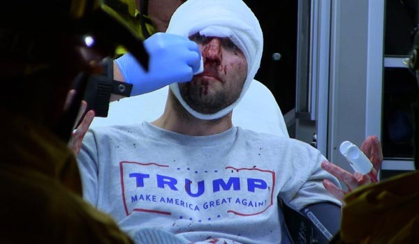 ▲ 트럼프 지지 티셔츠를 입고 걷다 시위대에 무차별 집단폭행을 당해 앰뷸런스에 실려가는 남성. 이런 일이 현재 美전역에서 일어나고 있다. ⓒ유튜브 트럼프 지지자 공격 영상 캡쳐
