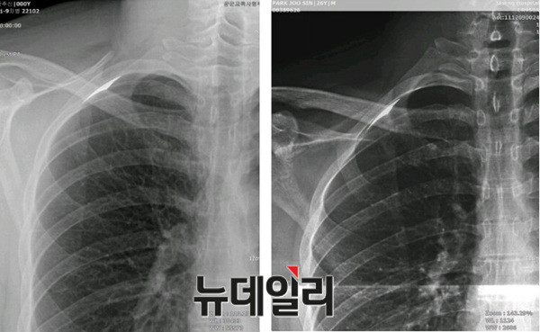 ▲ 검찰 감정항목 2번에 제시된 박주신씨 명의 공군-자생 엑스레이. ⓒ 뉴데일리DB