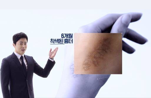 ▲ 한국메나리니 흉터치료제 '더마틱스 울트라'의 새 광고. ⓒ한국메나리니