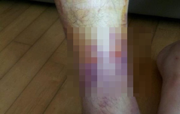 ▲ ⓒ사진=연합뉴스