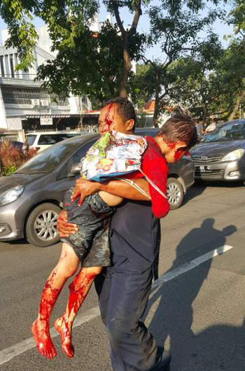 ▲ 수라바야 자폭테러 직후 부상당한 어린아이를 후송하는 사람. ⓒ인도네시아 SNS 관련 사진 캡쳐