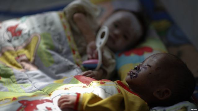 ▲ 지난 2011년 북한 황해남도 해주의 한 병원에 영양실조로 입원한 어린이들. ⓒ VOA