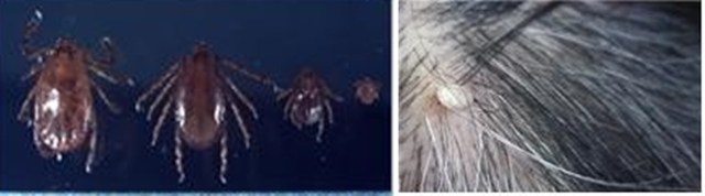 ▲ 작은소피참진드기(좌), 머리에 붙어 흡혈하고 있는 
작은소피참진드기(우).ⓒ대구시