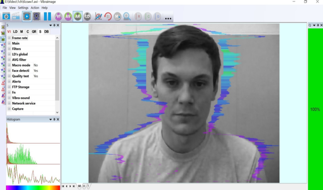 ▲ 얼굴의 미세한 움직임을 측정해 심리상태를 분석해주는 애플리케이션 '마인드 인'의 시연 모습 ⓒ 메탈헬스케어