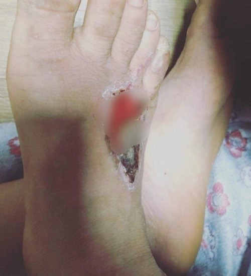 ▲ 집단폭행 피해를 입은 제천 한 학교 학생 보호자가 페이스북 '제천대신 말해드립니다'에 올린 사진.ⓒ제천대신 말해드립니다 캡처