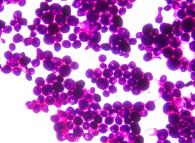 ▲ 토종 효모 균주.ⓒ충북도농업기술원