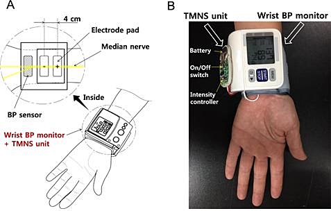▲ 혈압 낮추는 고혈압 치료 장치.ⓒ대구한의대