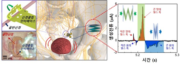 ▲ 개발한 신경조절 인터페이스를 적용한 신경자극기 삽입 모식도 및 실제 모습(좌)과 신경자극전류 흐름 그래프(우).ⓒDGIST