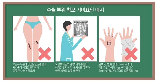 ▲ 다른 부위 수술 관련 환자안전 경보 예시. ⓒ의료기관평가인증원