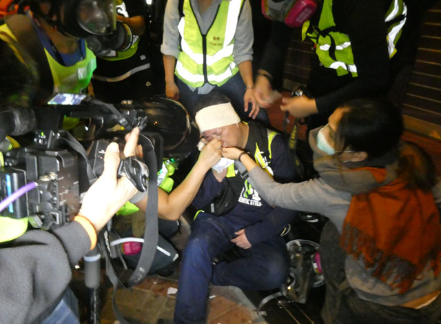 ▲ 크리스마스 이브 몽콕 시위에서 경찰의 최루볼 공격을 받고 부상당한 홍콩기자ⓒ허동혁