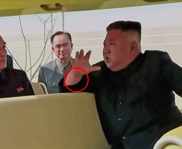 ▲ 잠적 후 20일만에 모습을 드러낸 북한 김정은의 손목에 바늘 자국으로 보이는 빨간 점이 포착됐다. ⓒ미국 북한전문매체 NK뉴스