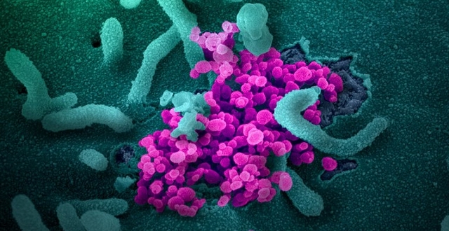 ▲ 코로나19 바이러스의 전자 현미경 영상.ⓒNIH(미국 국립보건원)